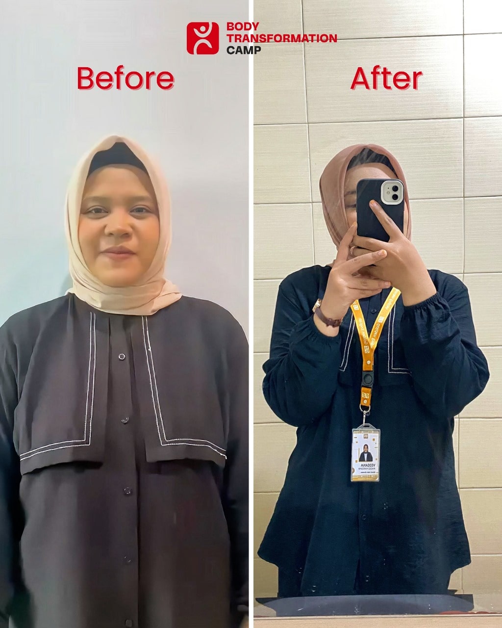 Side by side before and after face transformation of a woman with acne and clear skin