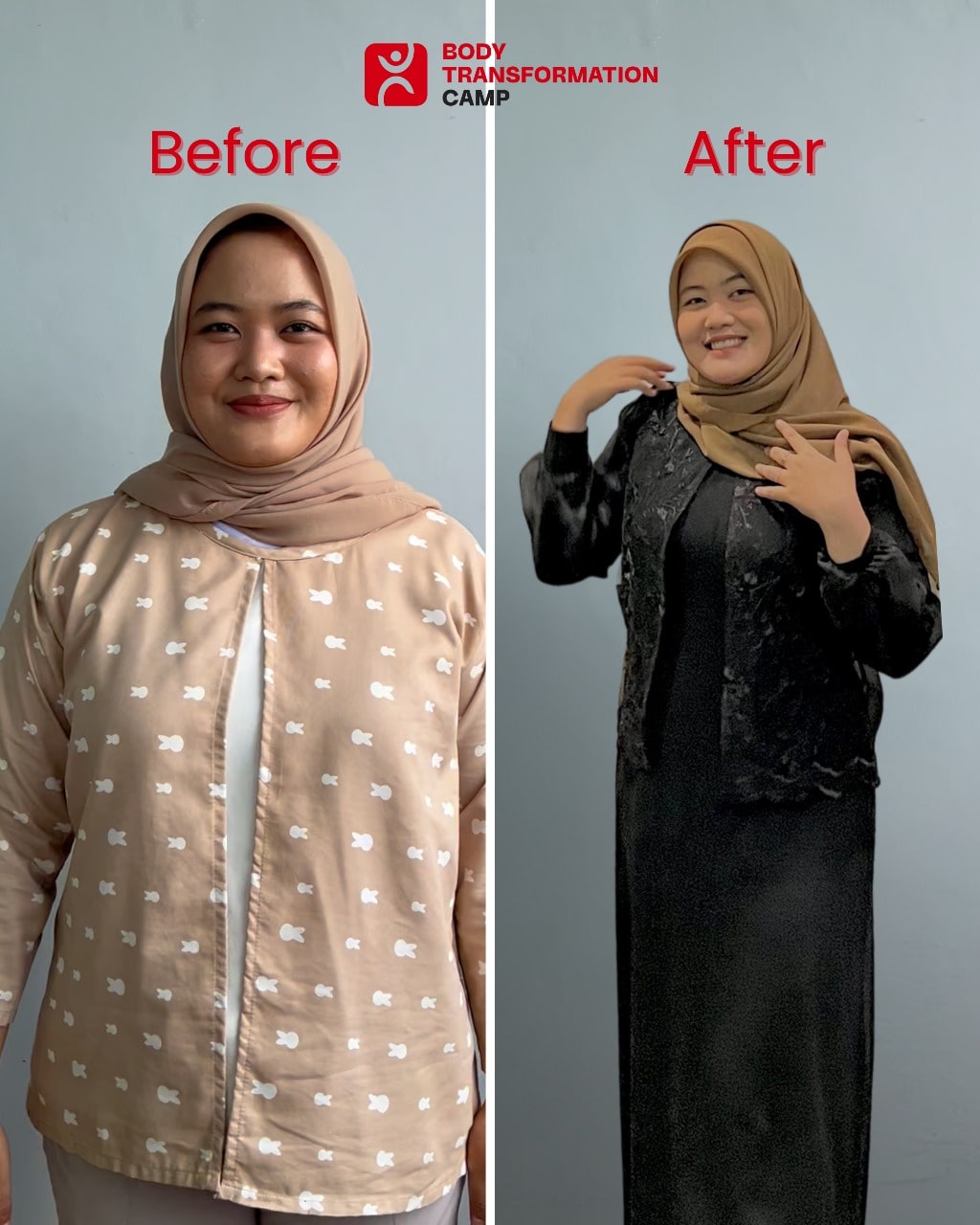 Side by side before and after face transformation of a woman with acne and clear skin
